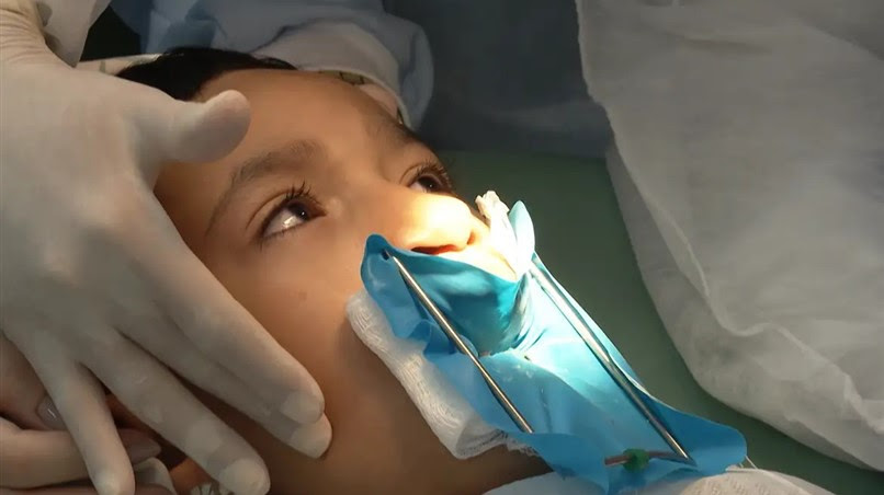 agora-e-lei:-ampliado-no-rj-tratamento-para-fissura-labiopalatal agora-e-lei:-ampliado-no-rj-tratamento-para-fissura-labiopalatal